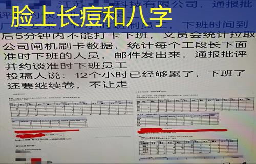  脸上长痘和八字